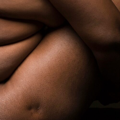 VzQ7i975Rqs-POST Obesity, the Pelvic Floor and Surgery Risk